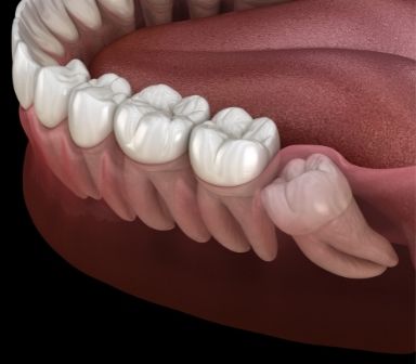 cirurgia oral