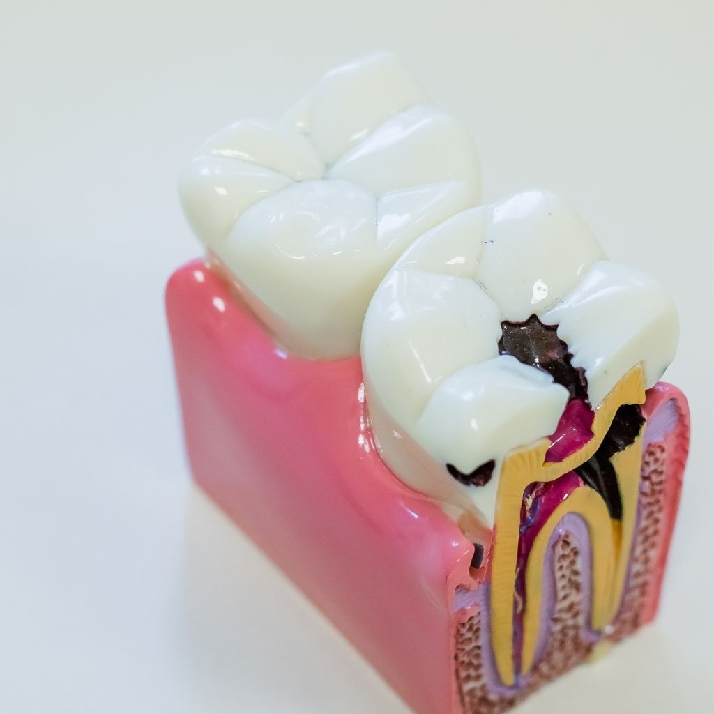 endodontia