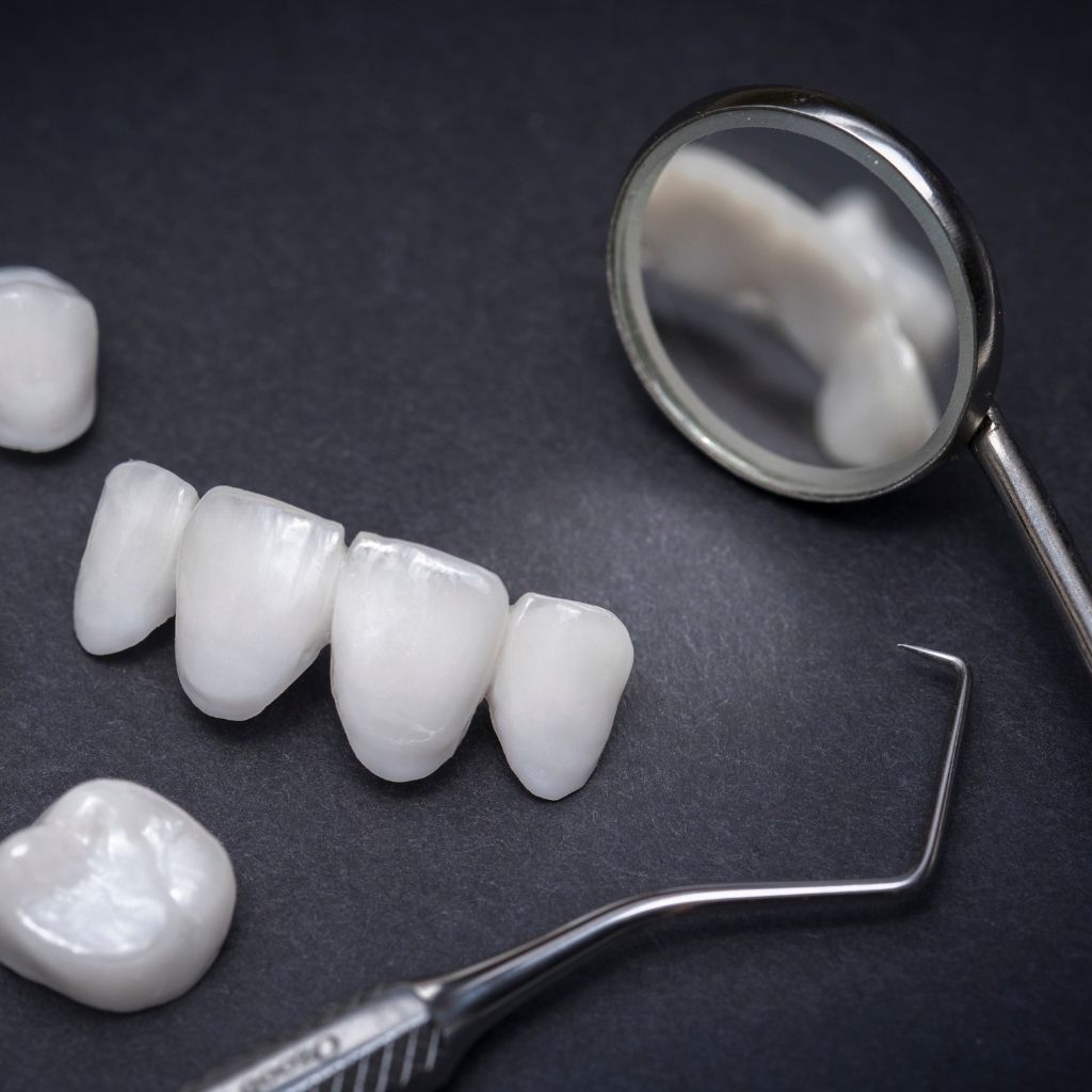 estética dentária