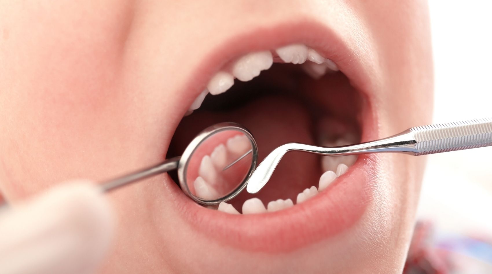 odontopediatria