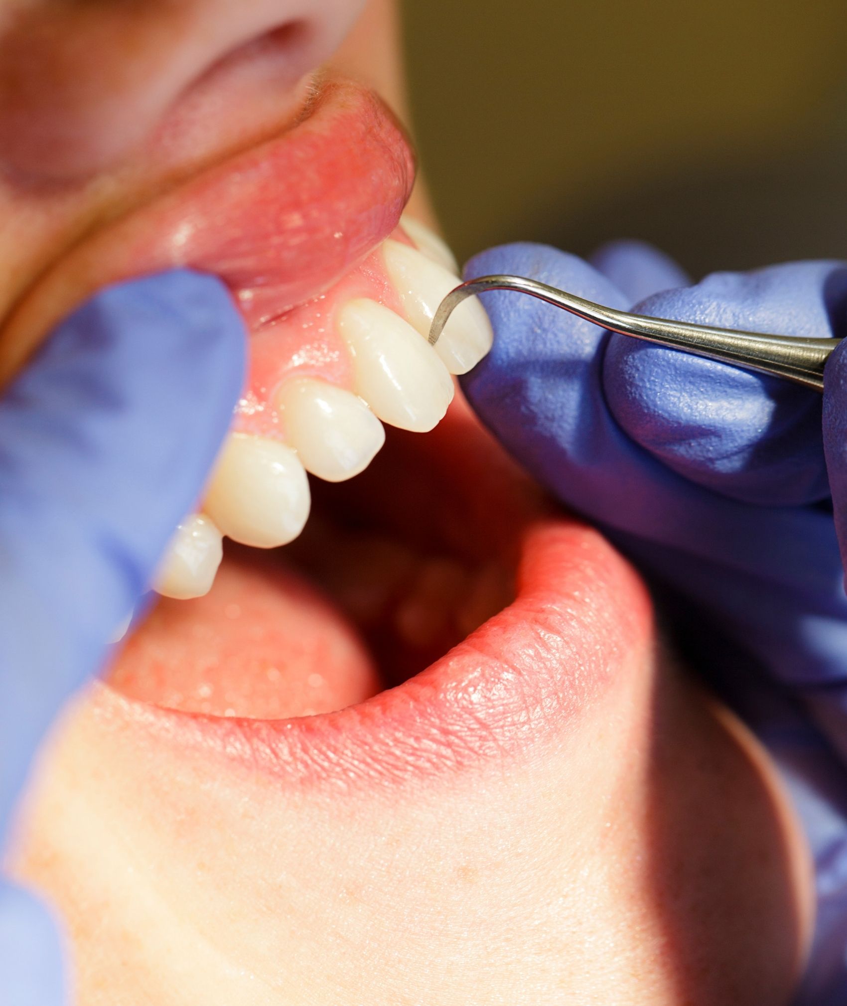 periodontologia