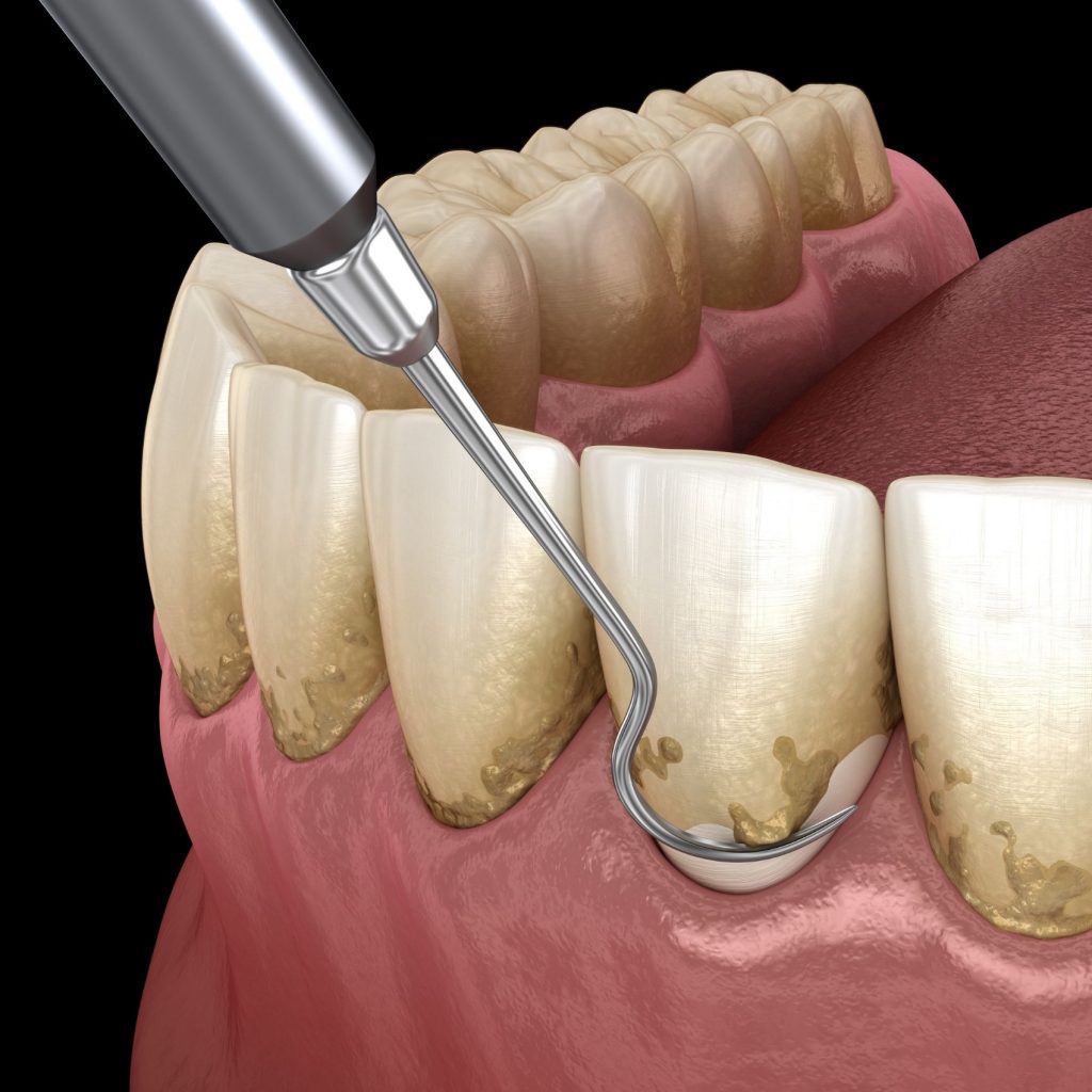 periodontologia