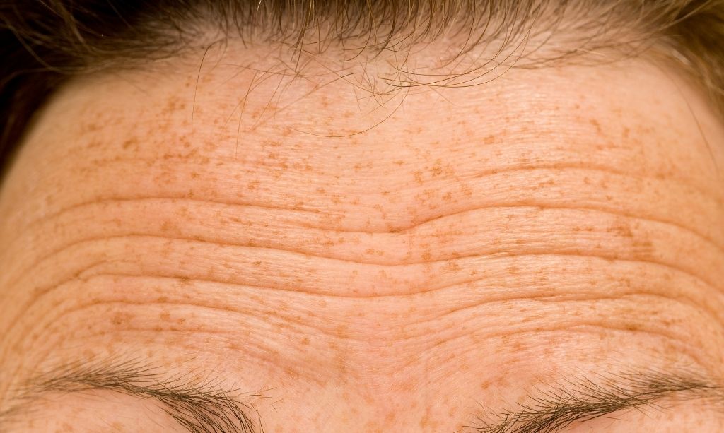 harmonização orofacial