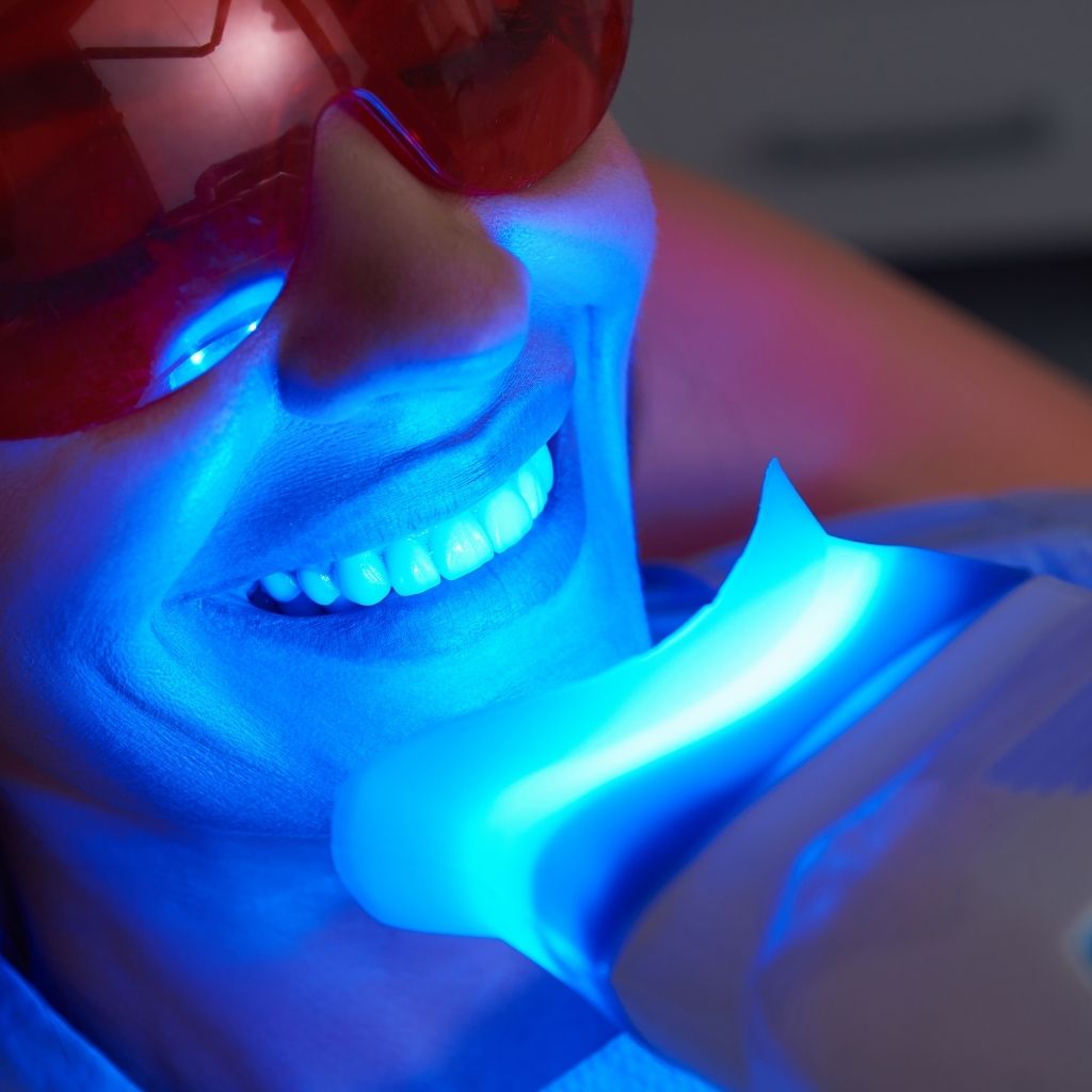 branqueamento dentário\